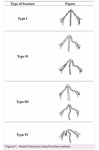 Examination of the Clinic, Radiologic, and Demographic Characteristics of 436 Patients with Nasal Fracture