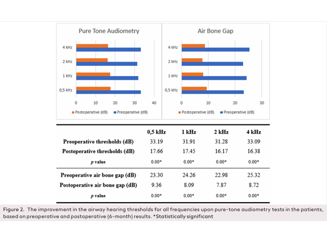 Evaluation of Young Surgeon&rsquo;s Experience and Outcomes in Endoscopic Tympanoplasty Surgery