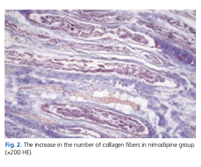 The effect of nimodipine and prednisolone on traumatic facial nerve injury treatment