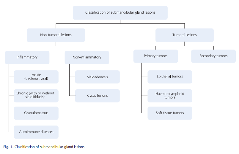 Differential diagnosis of submandibular gland swellings