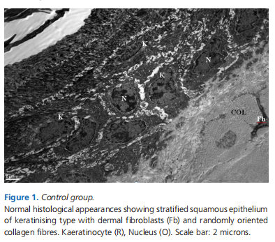 The Effect of N-butyl-2-Cyanoacrylate on Wound Healing in the Head and Neck Region