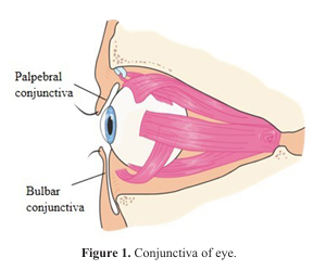 Development in therapeutic strategies for allergic conjunctivitis