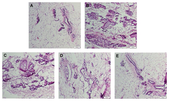 The hyperplasia of the mammary gland effect of the Mongolian Remedy RuXian-I in rats reduced by estrogen and progesterone via inhibition of MAPK and NF-&kappa;B pathways